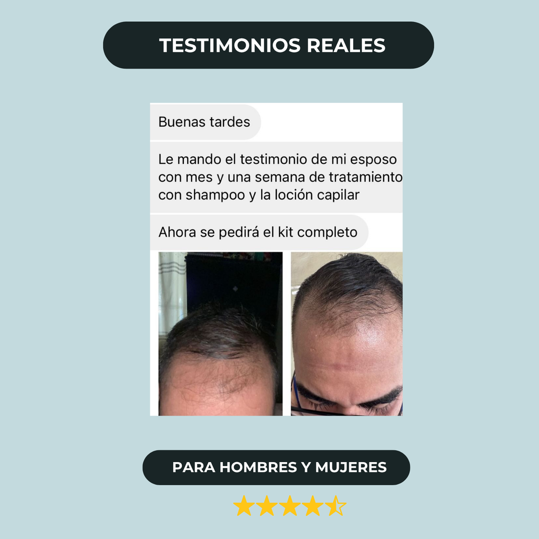 Shampoo Anticaida