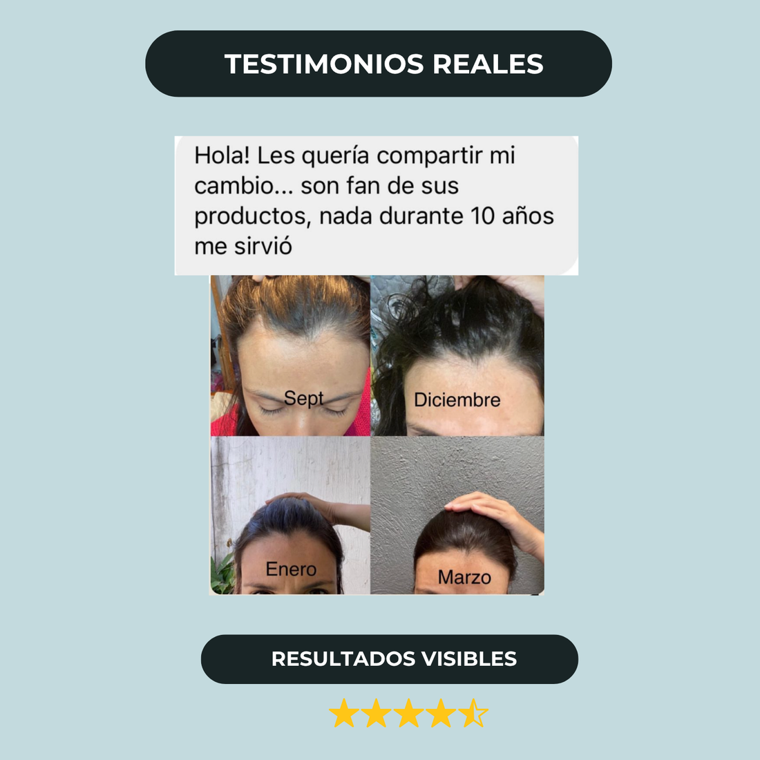Tratamiento Anticaída