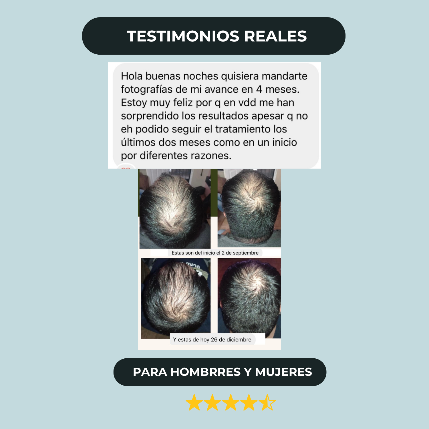 Tratamiento Anticaída